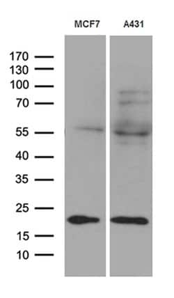 Invitrogen TIMM23 Monoclonal Antibody (OTI2F5) 100 &mu;L; Unconjugated:Antibodies,