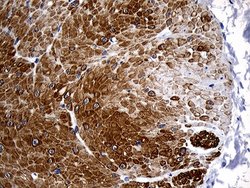 Invitrogen C1orf111 Monoclonal Antibody (OTI2A9) 100 &mu;L; Unconjugated:Antibodies,