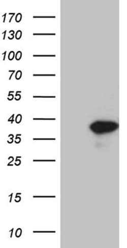 Invitrogen C1orf111 Monoclonal Antibody (OTI2A9) 100 &mu;L; Unconjugated:Antibodies,