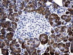 C1orf111 Monoclonal Antibody (OTI2F3):Antibodies, Monoclonal