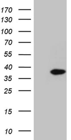 C1orf111 Monoclonal Antibody (OTI2F3):Antibodies, Monoclonal