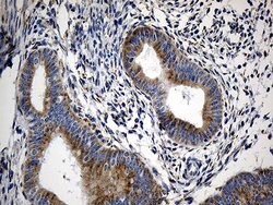 Invitrogen CCDC22 Monoclonal Antibody (OTI5C1) 100 &mu;L; Unconjugated:Antibodies,