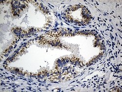 Invitrogen CCDC22 Monoclonal Antibody (OTI5C1) 100 &mu;L; Unconjugated:Antibodies,