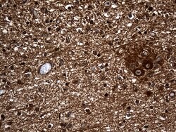 Invitrogen GNPAT Monoclonal Antibody (OTI1E7) 100 &mu;L; Unconjugated:Antibodies,