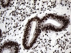 Invitrogen ZNF670 Monoclonal Antibody (OTI6E10) 100 &mu;L | Buy Online | Invitrogen&trade; | Fisher Scientific