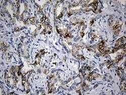 Invitrogen CEP72 Monoclonal Antibody (OTI4D2) 100 &mu;L; Unconjugated:Antibodies,