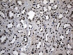 Invitrogen ZNF558 Monoclonal Antibody (OTI2C4) 100 &mu;L; Unconjugated:Antibodies,