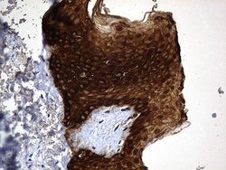 Invitrogen KRT84 Monoclonal Antibody (OTI2D1) 100 &mu;L; Unconjugated:Antibodies,