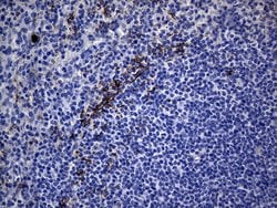 Invitrogen KRT84 Monoclonal Antibody (OTI2D1) 100 &mu;L; Unconjugated:Antibodies,