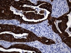 Invitrogen KRT84 Monoclonal Antibody (OTI2D1) 100 &mu;L; Unconjugated:Antibodies,