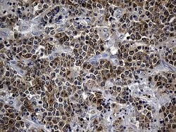 Invitrogen SMAP2 Monoclonal Antibody (OTI9B6) 100 &mu;L; Unconjugated:Antibodies,