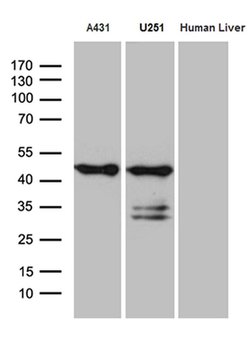 Invitrogen SMAP2 Monoclonal Antibody (OTI9B6) 100 &mu;L; Unconjugated:Antibodies,