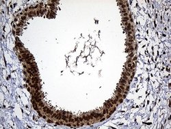 Invitrogen RAD21 Monoclonal Antibody (OTI6C10) 100 &mu;L; Unconjugated:Antibodies,