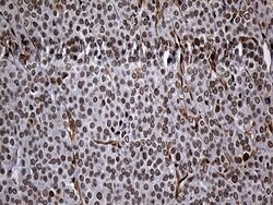 Invitrogen RAD21 Monoclonal Antibody (OTI6C10) 100 &mu;L; Unconjugated:Antibodies,