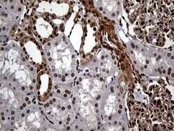 Invitrogen RAD21 Monoclonal Antibody (OTI6C10) 100 &mu;L; Unconjugated:Antibodies,