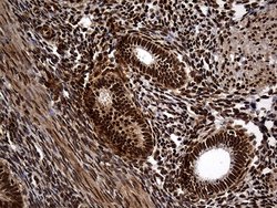 Invitrogen RAD21 Monoclonal Antibody (OTI6C10) 100 &mu;L; Unconjugated:Antibodies,