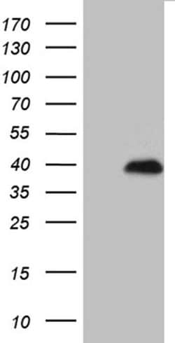 Invitrogen RNF4 Monoclonal Antibody (OTI1F6) 100 &mu;L; Unconjugated:Antibodies,