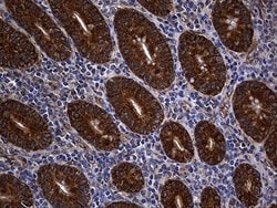 Invitrogen ALDH7A1 Monoclonal Antibody (OTI1A9) 100 &mu;L; Unconjugated:Antibodies,
