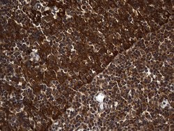 Invitrogen ALDH7A1 Monoclonal Antibody (OTI1A9) 100 &mu;L; Unconjugated:Antibodies,