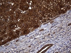 Invitrogen ALDH7A1 Monoclonal Antibody (OTI1A9) 100 &mu;L; Unconjugated:Antibodies,