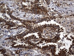 Invitrogen ALDH7A1 Monoclonal Antibody (OTI1A9) 100 &mu;L; Unconjugated:Antibodies,