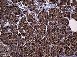 Invitrogen ALDH7A1 Monoclonal Antibody (OTI1A9) 100 &mu;L; Unconjugated:Antibodies,