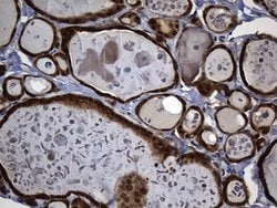 Invitrogen ALDH7A1 Monoclonal Antibody (OTI1A9) 100 &mu;L; Unconjugated:Antibodies,