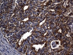 Invitrogen ALDH7A1 Monoclonal Antibody (OTI1A9) 100 &mu;L; Unconjugated:Antibodies,