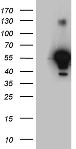 Invitrogen ALDH7A1 Monoclonal Antibody (OTI1A9) 100 &mu;L; Unconjugated:Antibodies,