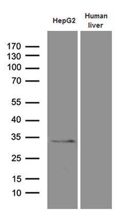 Invitrogen PHYHD1 Monoclonal Antibody (OTI1A6) 100 &mu;L | Buy Online | Invitrogen&trade; | Fisher Scientific
