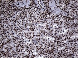 Invitrogen SPANXB1 Monoclonal Antibody (OTI6G2) 100 &mu;L; Unconjugated:Antibodies,
