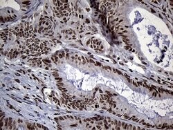Invitrogen SPANXB1 Monoclonal Antibody (OTI6G2) 100 &mu;L; Unconjugated:Antibodies,