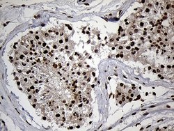 Invitrogen SPANXB1 Monoclonal Antibody (OTI6G2) 100 &mu;L; Unconjugated:Antibodies,