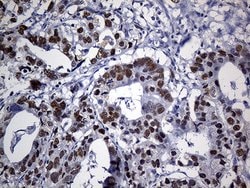 Invitrogen PPP2R1B Monoclonal Antibody (OTI8B6) 100 &mu;L; Unconjugated:Antibodies,