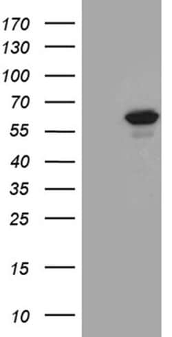 Invitrogen PPP2R1B Monoclonal Antibody (OTI8B6) 100 &mu;L; Unconjugated:Antibodies,