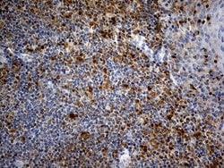 Invitrogen FHIT Monoclonal Antibody (OTI6B4) 100 &mu;L; Unconjugated:Antibodies,