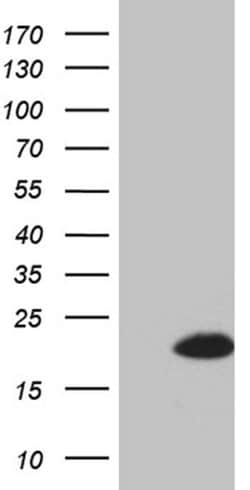 Invitrogen FHIT Monoclonal Antibody (OTI6B4) 100 &mu;L; Unconjugated:Antibodies,