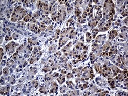 Invitrogen FHIT Monoclonal Antibody (OTI1D7) 100 &mu;L; Unconjugated:Antibodies,