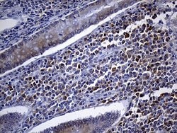 Invitrogen FHIT Monoclonal Antibody (OTI1D7) 100 &mu;L; Unconjugated:Antibodies,