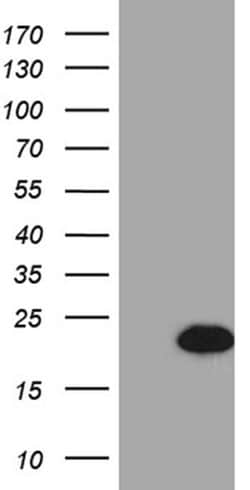 Invitrogen FHIT Monoclonal Antibody (OTI1D7) 100 &mu;L; Unconjugated:Antibodies,