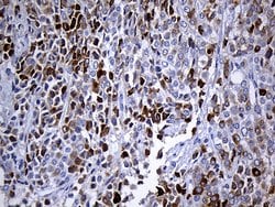 Invitrogen TFF3 Monoclonal Antibody (OTI5B2) 100 &mu;L; Unconjugated:Antibodies,