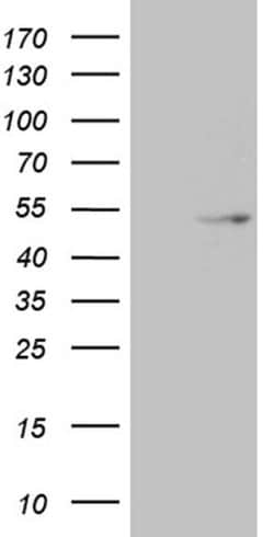 Invitrogen Dnmt2 Monoclonal Antibody (OTI8H10) 100 &mu;L; Unconjugated:Antibodies,