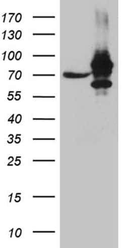 Invitrogen IGF2BP3 Monoclonal Antibody (OTI6A3) 100 &mu;L | Buy Online | Invitrogen&trade; | Fisher Scientific