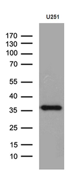 Invitrogen DTWD1 Monoclonal Antibody (OTI2C2) 100 &mu;L; Unconjugated:Antibodies,