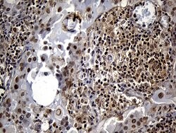 DTWD1 Monoclonal Antibody (OTI1D2):Antibodies, Monoclonal