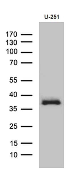 DTWD1 Monoclonal Antibody (OTI1D2):Antibodies, Monoclonal