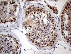 Invitrogen Zfp57 Monoclonal Antibody (OTI1E2) 100 &mu;L; Unconjugated:Antibodies,