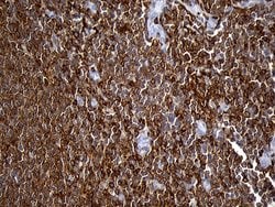 Invitrogen SH3BP1 Monoclonal Antibody (OTI1C9) 100 &mu;L; Unconjugated:Antibodies,