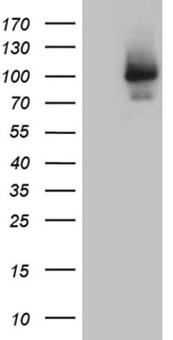 Invitrogen ALS2CR11 Monoclonal Antibody (OTI7A8) 100 &mu;L | Buy Online | Invitrogen&trade; | Fisher Scientific