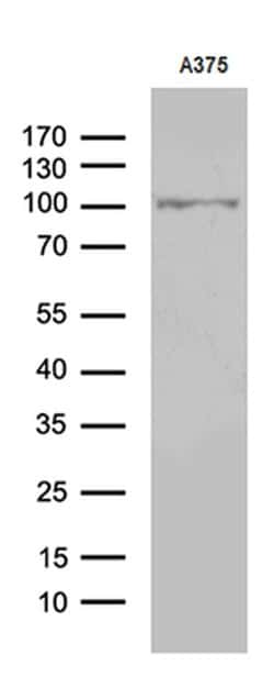 Invitrogen ALS2CR11 Monoclonal Antibody (OTI7A8) 100 &mu;L | Buy Online | Invitrogen&trade; | Fisher Scientific